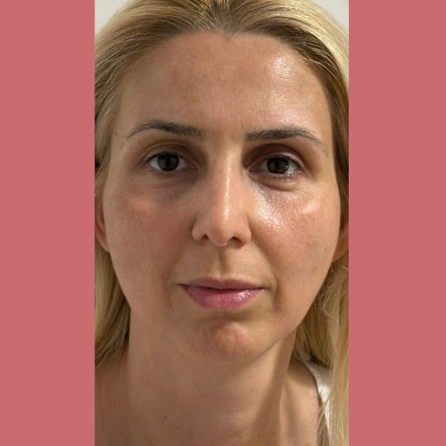 Miljana Slavković